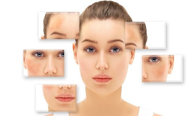 Safed Daag Ka Dawa: Sabse Behtareen Ilaj Kaun Sa Hai?